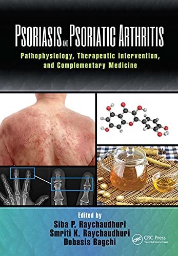 Psoriasis And Psoriatic Arthritis
