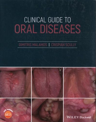 Clinical Guide To Oral Diseases