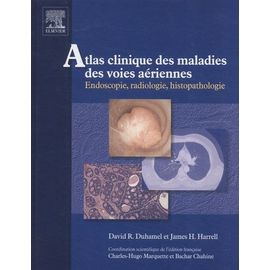 Atlas Clinique Des Maladies Des Voies Aériennes - Endoscopie, Radiologie, Histopathologie (1 Cd-Rom)