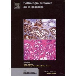 Pathologie Tumorale De La Prostate