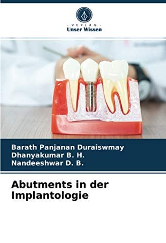 Abutments In Der Implantologie