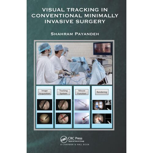 Visual Tracking In Conventional Minimally Invasive Surgery