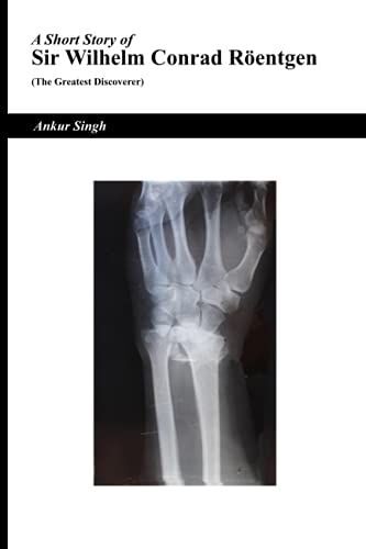 A Short Story Of Sir Wilhelm Conrad Rã¶Entgen (The Greatest Discoverer)