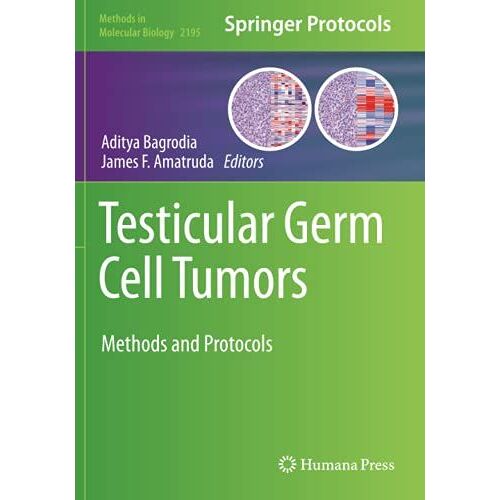 Testicular Germ Cell Tumors