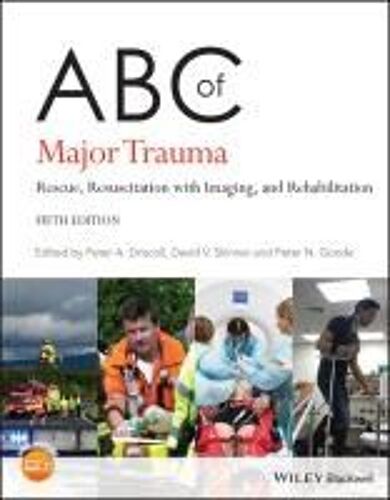 Abc Of Major Trauma
