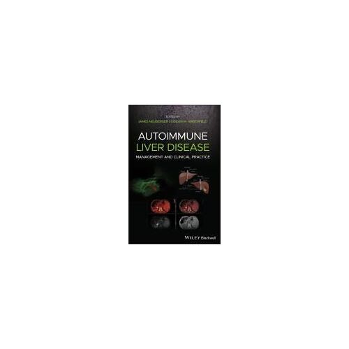 Autoimmune Liver Disease
