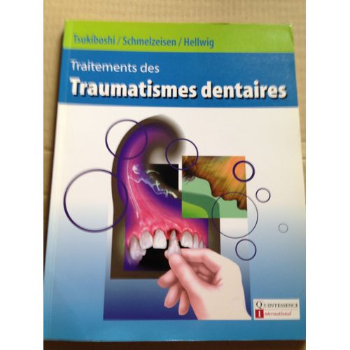 Traitement Des Traumatismes Dentaires