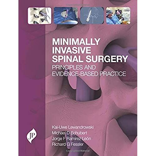 Minimally Invasive Spinal Surgery: Principles And Evidence-Based Practice