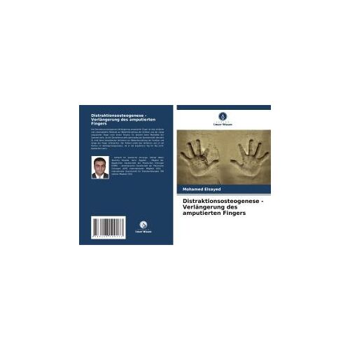 Distraktionsosteogenese - Verlängerung Des Amputierten Fingers