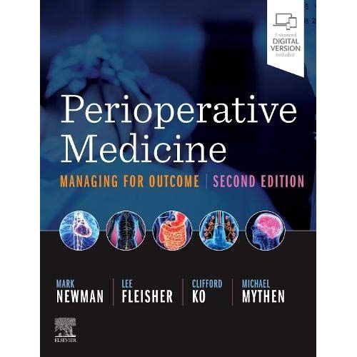 Perioperative Medicine