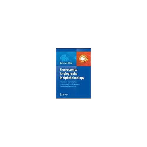 Fluorescence Angiography In Ophthalmology