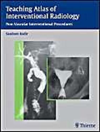 Teaching Atlas Of Interventional Radiology: Non-Vascular Interventional Procedures