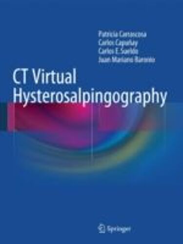 Ct Virtual Hysterosalpingography