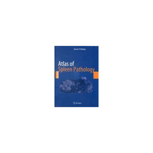 Atlas Of Spleen Pathology