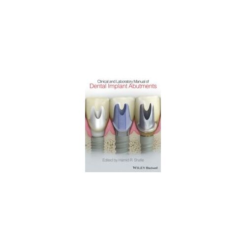 Clinical And Laboratory Manual Of Dental Implant Abutments