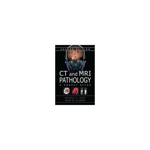 Grey, M: Ct & Mri Pathology: A Pocket Atlas