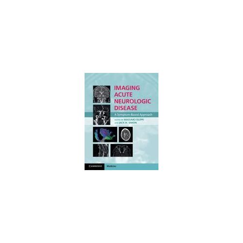 Imaging Acute Neurologic Disease