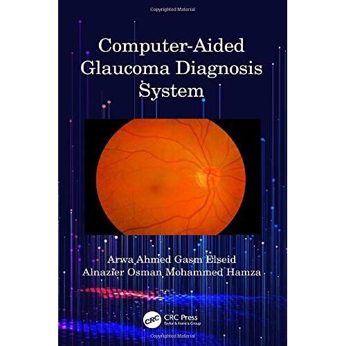 Computer-Aided Glaucoma Diagnosis System