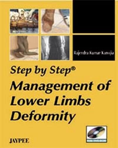 Step By Step Management Of Lower Limbs Deformity (With Dvd Rom)