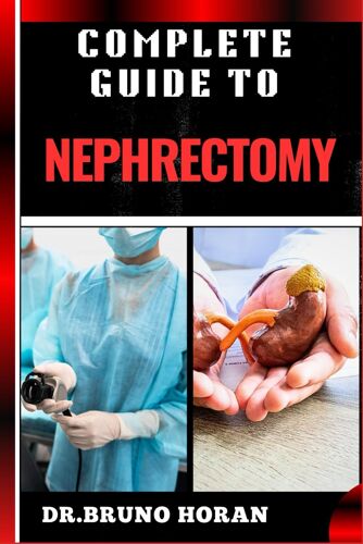Complete Guide To Nephrectomy: Essential Handbook To Kidney Removal, Techniques, Types, Indications, Risks, Recovery, And Post-Operative Care