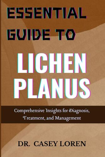 Essential Guide To Lichen Planus: Comprehensive Insights For Diagnosis, Treatment, And Management