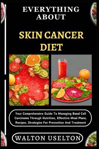 Everything About Skin Cancer Diet: Your Comprehensive Guide To Managing Basal Cell Carcinoma Through Nutrition, Effective Meal Plans, Recipes, Strategies For Prevention And Treatment