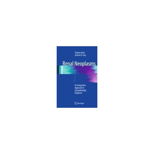 Renal Neoplasms