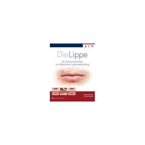 Die Lippe