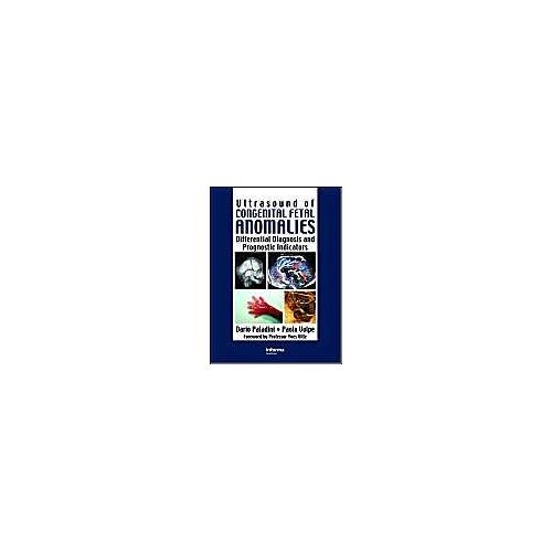 Ultrasound Of Congenital Fetal Anomalies