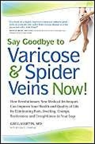 Say Goodbye To Varicose & Spider Veins Now!