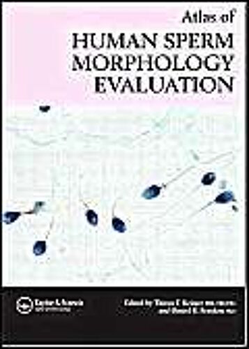 Atlas Of Sperm Morphology Evaluatio