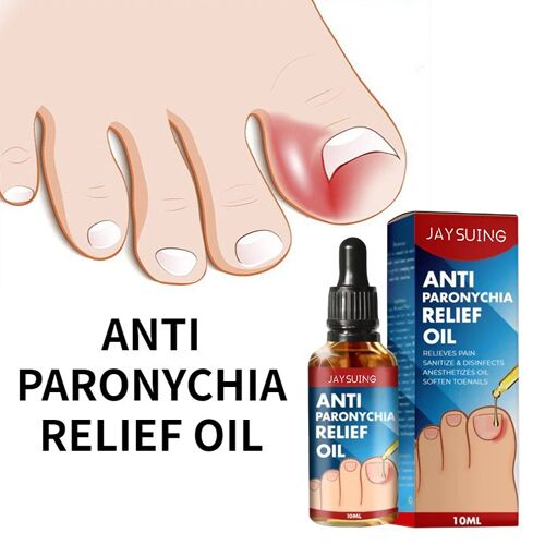 Soin Des Ongles Anti-Griffes, Réparation De L'huile, Incrustation Des Mains Et Des Pieds, Type D'épaississement, Brillance Douce, Pour Les Ongles Gris 