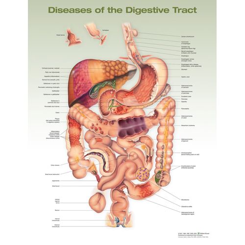 Diseases Of The Digestive Tract Anatomical Chart