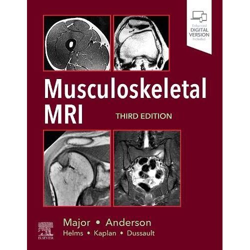 Musculoskeletal Mri