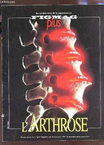 Figmag Plus / L'arthrose / Non C'est Pas Une Fatalite - Sport  Et Rthrose - Pour Mieux Soigner L'arthrose - La Microscopie Rmn - Etc...