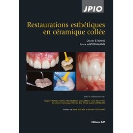Restaurations Esthétiques En Céramique Collée