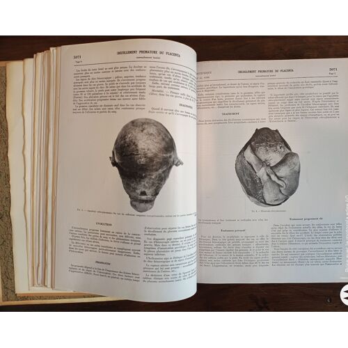 Encyclopédie Médico-Chirurgicale - Obstetrique 2 Volumes