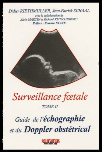 Surveillance Foetale - Tome Ii, Guide De L'écographie Et Du Doppler Obstétrical