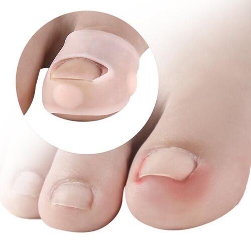 Appareil D'incrustation Pour Les Ongles, Pour Empêcher L'ongle De Se Transformer En Pied Chair 