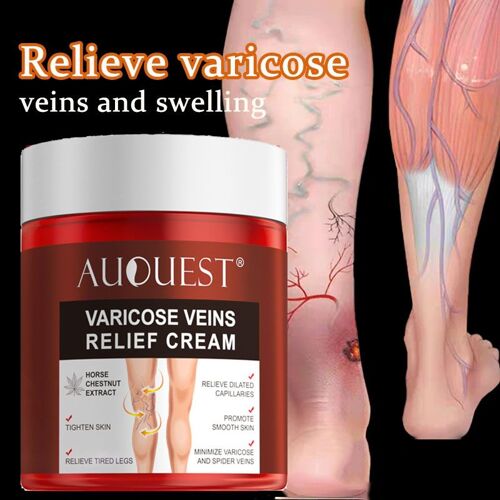 Crème De Traitement Pour Les Varices, Pommade Pour La Vascularite, Phlébite, Plâtre, Élimination Du Gonflement Musculaire