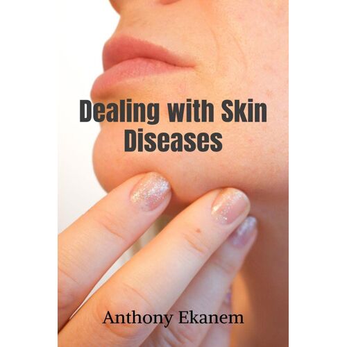 Dealing With Skin Diseases
