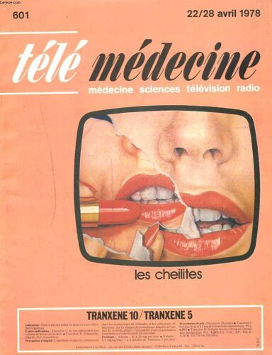 Telemedecine, Medecine, Sciences, Television, Radio N°601, 22-28 Avril 1978. Les Cheilites / Age De Fer Et Grain De Self / Les Enfants Prodiges / Le Guide Medecine Sante, Le Cancer, Les ...
