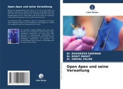 Open Apex Und Seine Verwaltung