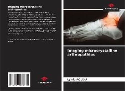 Imaging Microcrystalline Arthropathies