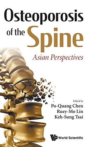 Osteoporosis Of The Spine