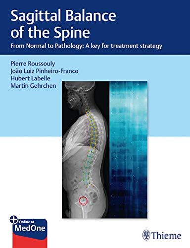 Sagittal Balance Of The Spine