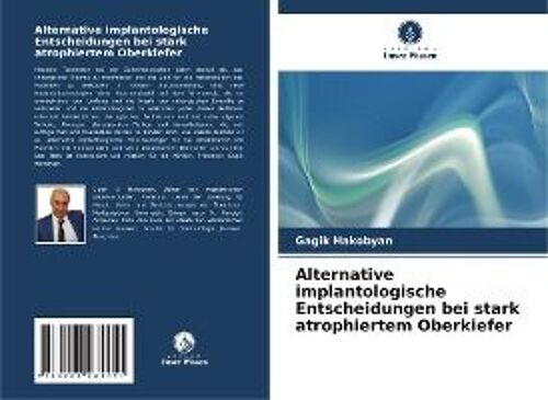 Alternative Implantologische Entscheidungen Bei Stark Atrophiertem Oberkiefer