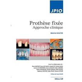 Prothèse Fixée - Approche Fixée