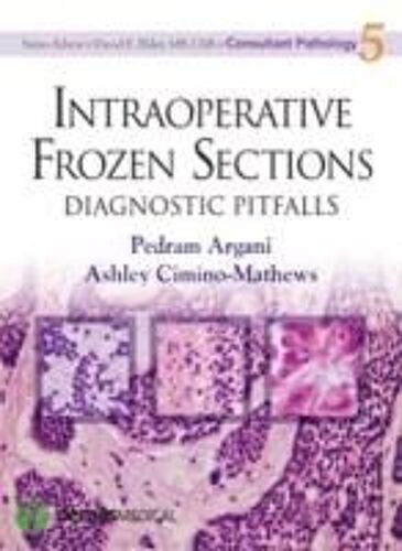 Intraoperative Frozen Sections