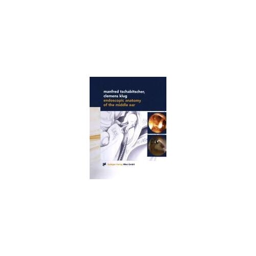 Endoscopic Anatomy Of The Middle Ear